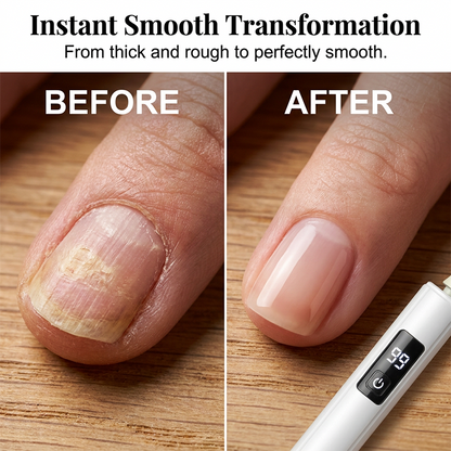 💎 50% RABATT I BEGRENSET TID! ✨Profesjonell elektrisk neglefil – oppgrader neglepleien din med 99 hastigheter og 4 tilbehør ✨💅